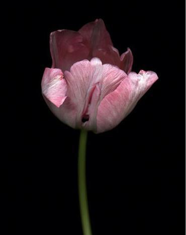 女人二十种外阴照片：女人外阴的形状照片与生理知识