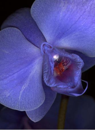 女人二十种外阴照片：女人外阴的形状照片与生理知识