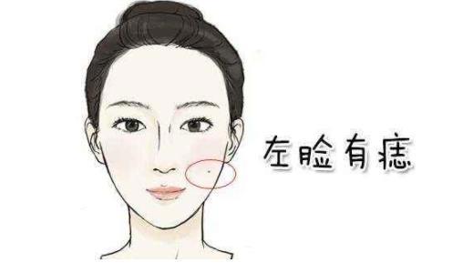 女人那里有痣好全身痣位置：女人富贵痣一般都长在哪