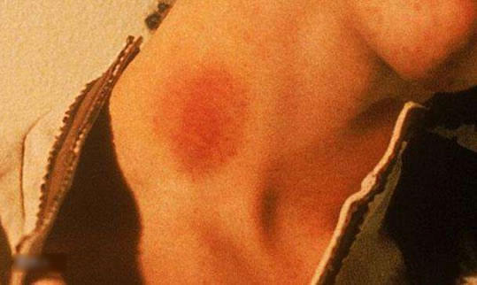 男女生为什么要吸草莓，成功种个草莓及消除方法