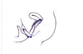 避孕套方法演示：女用避孕套使用方法教程演示