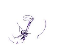 避孕套方法演示：女用避孕套使用方法教程演示