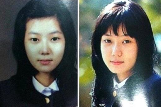 林秀香整容被质疑：早期照片被曝光