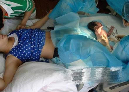 生孩子顺产正面图片大全