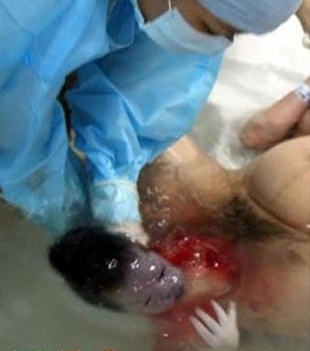 生孩子顺产正面图片大全