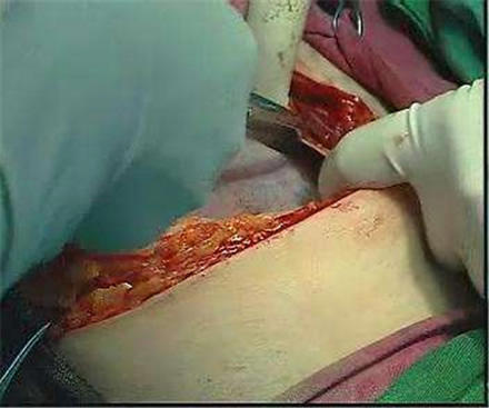 生孩子顺产正面图片大全