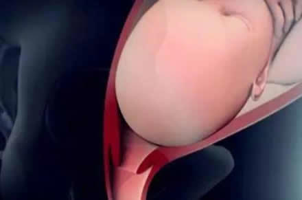 生孩子顺产正面图片大全