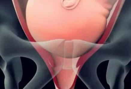 生孩子顺产正面图片大全