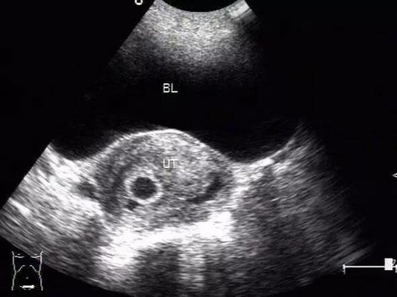 数据解读做B超单有这个一般是女孩