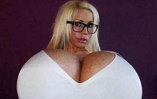 世界上最大胸重排行，安妮·霍金斯特纳胸部重达77斤