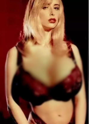 世界上最大胸重排行，安妮·霍金斯特纳胸部重达77斤