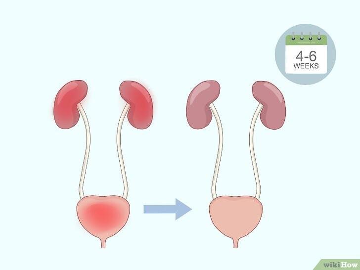 凯格尔运动正确做法 女性训练方法图解